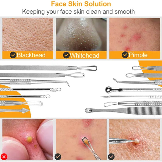 7 Pcs Blackhead Remover Kit Stainless Steel Pimple Comedone Acne Extractor Needle Tools - 5 - CJ