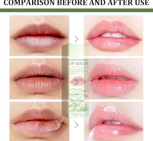 Eelhoe Moisturizing Lip Balm - 5.0 - CJ