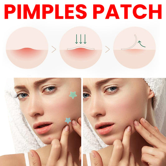 Jaysuing Star Colored Acne Stickers Repair Acne Pits & Marks Fade Acne Spots Blemishes Cover Acne Pimples - 5 - CJ