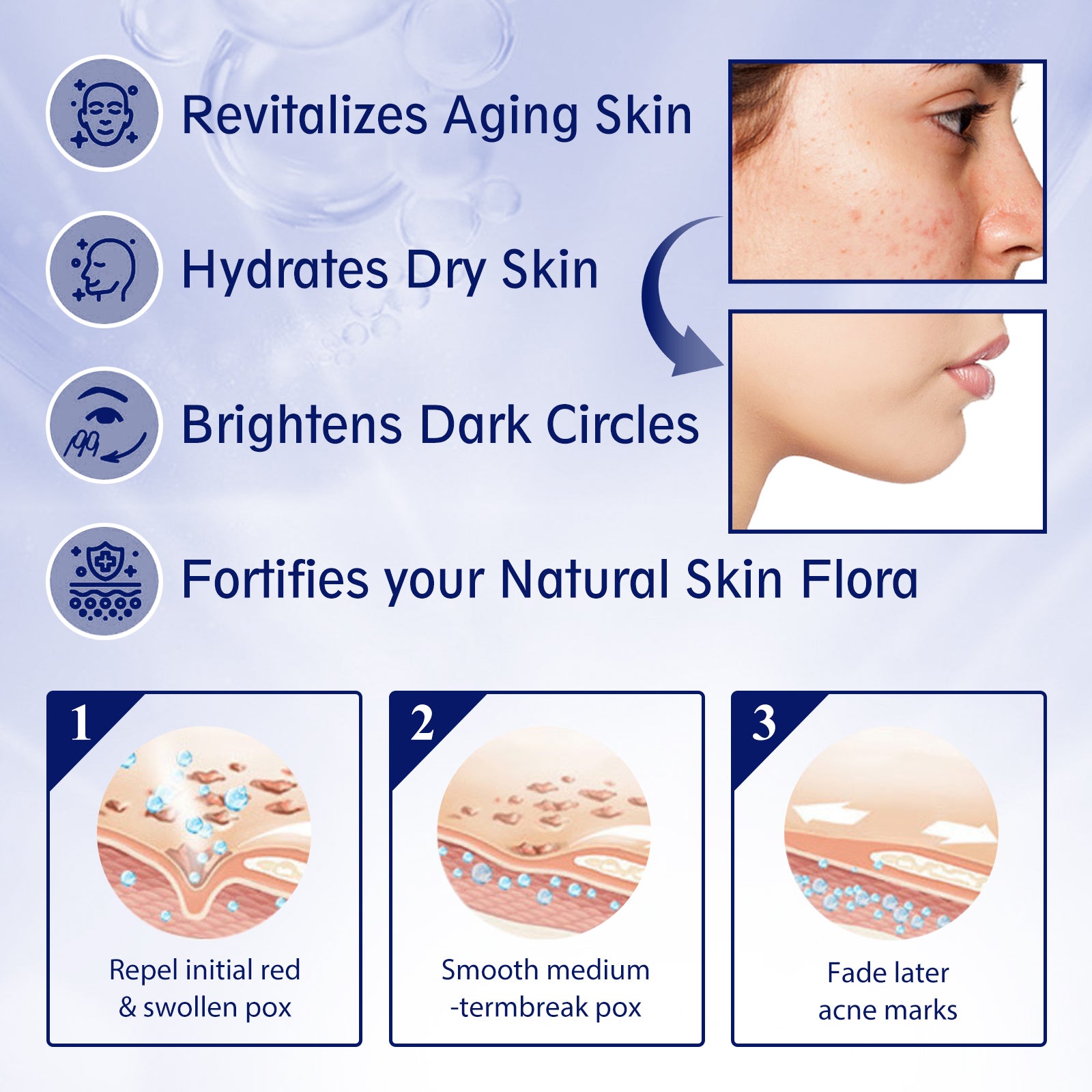 EELHOE Anti - aging Vitamin C Facial Essence, Reduces Spots Acne Fine Lines, Moisturizes Facial Essence - 5 - CJ