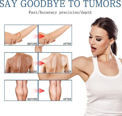 South Moon - Lipoma Removal Spray - 5 - CJ