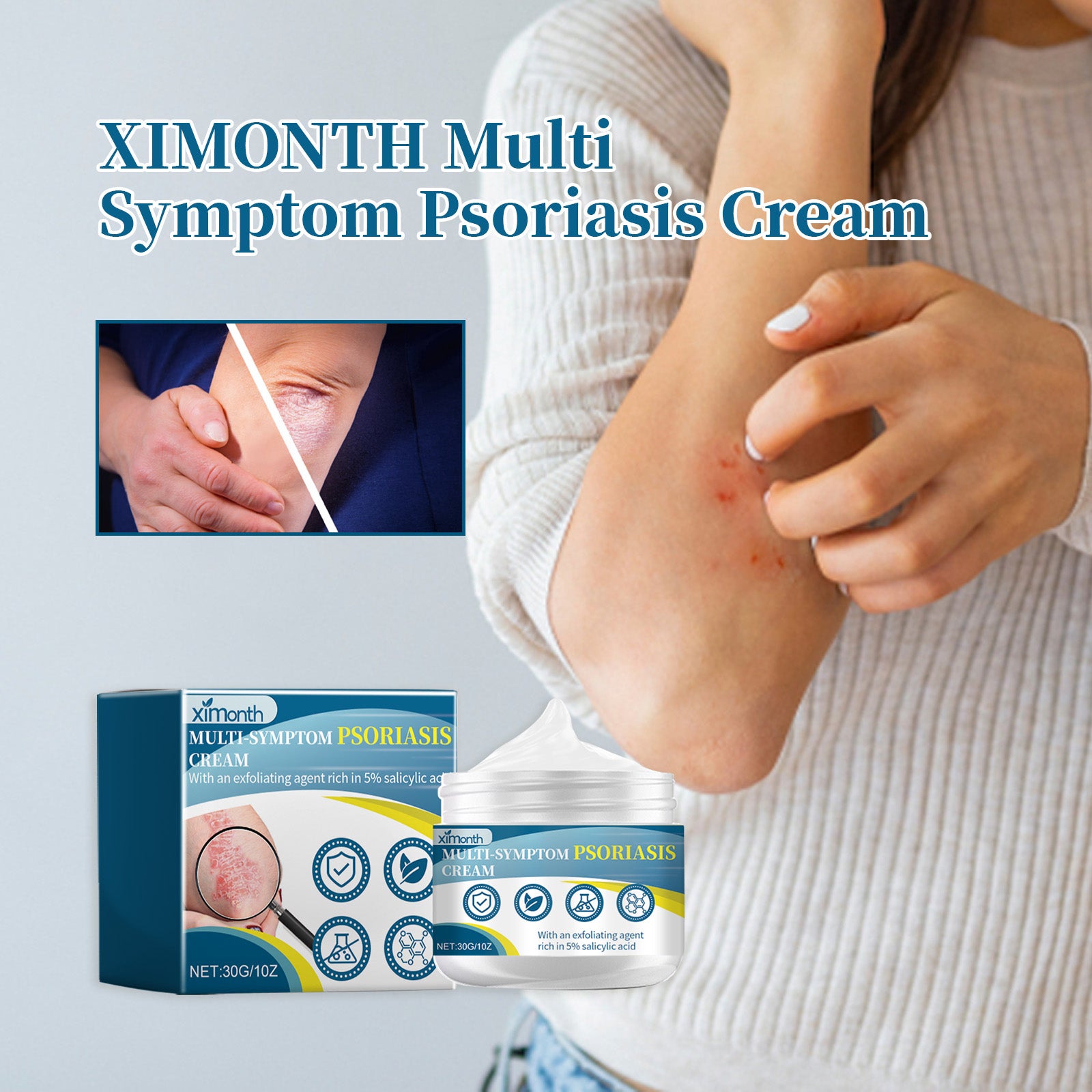 Ximonth Psoriasis Treatment Cream Repair Hand, Foot And Body Moss Redness And Itchy Skin Topical Treatment Cream - 5 - CJ