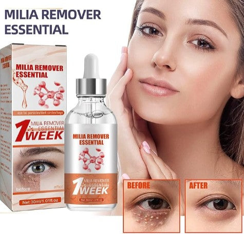 Smooth Milia Remover Serum - 5.0 - CJ