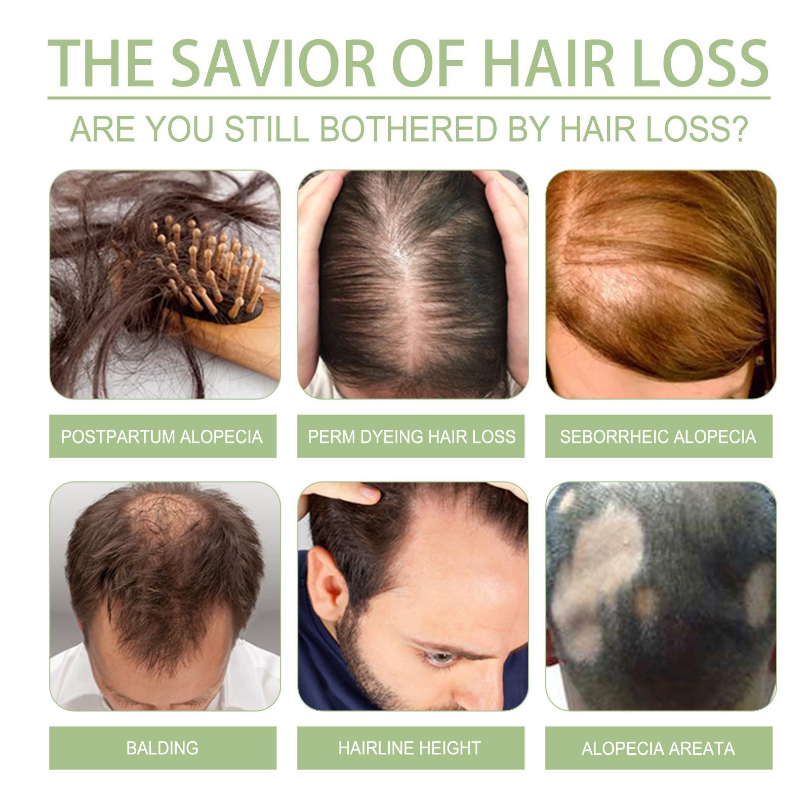 Ohoy Herbal Hair Oil Gently Nourishes The Scalp, Strengthens Hair, Cleanses The Scalp And Softens Hair - 5 - CJ