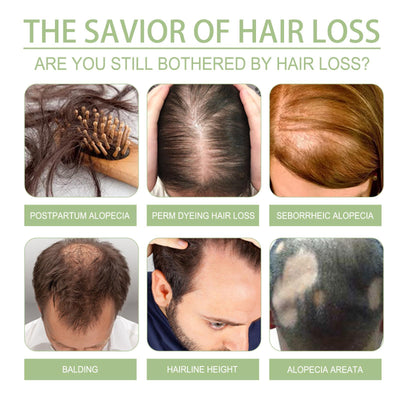 Ohoy Herbal Hair Oil Gently Nourishes The Scalp, Strengthens Hair, Cleanses The Scalp And Softens Hair - 5 - CJ