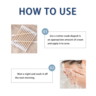 Hoygi Anti - Pimple Drying Lotion, Facial Cleansing And Repair Lighten Acne Marks And Pits, Close Your Mouth And Mild Skin Cream - 5 - CJ
