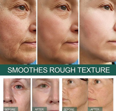 Eelhoe - Dark Spot Correcting Serum - 5 - CJ
