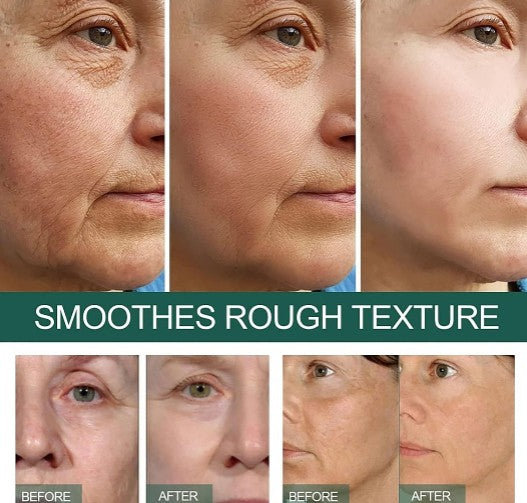 Eelhoe - Dark Spot Correcting Serum - 5 - CJ