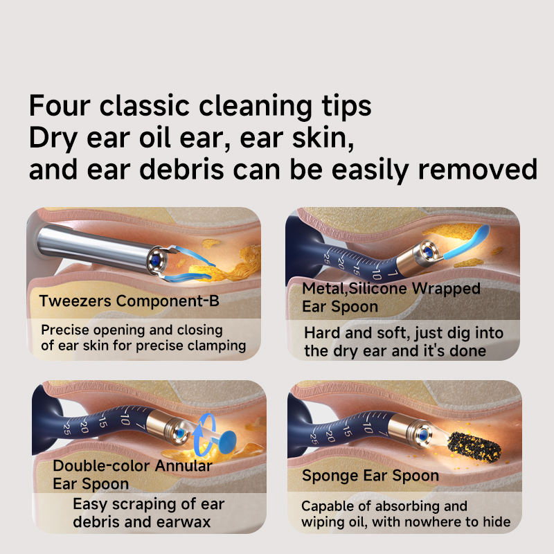 Bebird EarSight Plus Earwax Removal Tool Ear Canal Cleaner, Equipped With A Camera For Ear Nose Throat Examination. - 5 - CJ