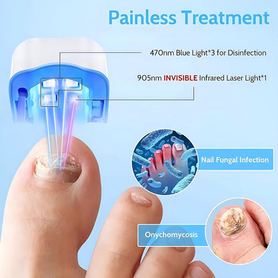 Nail Fungus Laser Treatment LED Light Device Effective Rechargeable Nail Fungus Remover Nail Fungus Cleaning Laser Device Repair Damaged Discolored Thick Fingernails - 5 - CJ