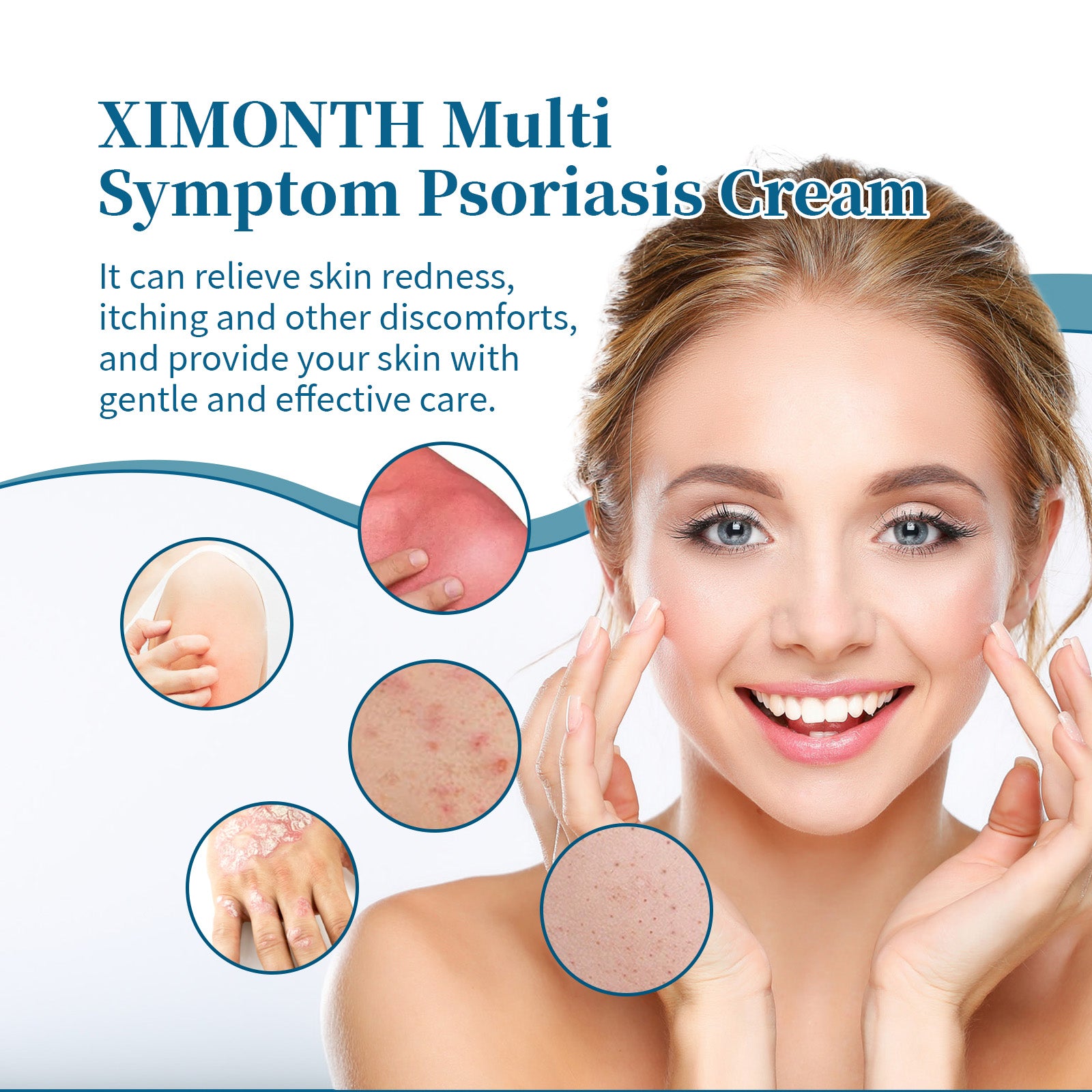 Ximonth Psoriasis Treatment Cream Repair Hand, Foot And Body Moss Redness And Itchy Skin Topical Treatment Cream - 5 - CJ