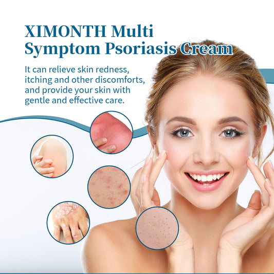 Ximonth Psoriasis Treatment Cream Repair Hand, Foot And Body Moss Redness And Itchy Skin Topical Treatment Cream - 5 - CJ