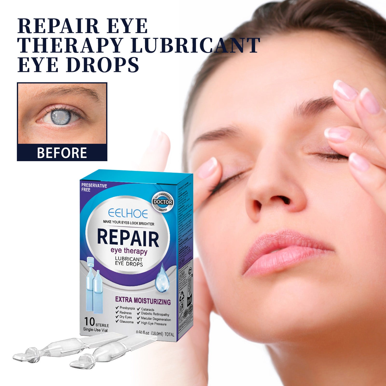 EELHOE Eye Drops Relieve Redness And Blurred Eyes Eye Fatigue Dryness Blurred Vision Moisturizing Eye Care Solution - 5 - CJ