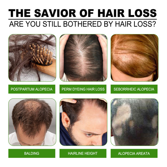 Jaysuing Hair Treatment, Strengthens Hair, Nourishes Root Growth And Thickens Scalp Massage Nutrient Solution - 5 - CJ