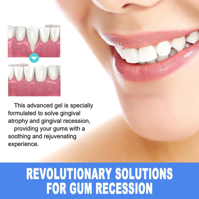 Yierhao Tooth Repair Gel, Repair Gums, Clean Teeth Stains, Tartar, Oral Care - 5 - CJ