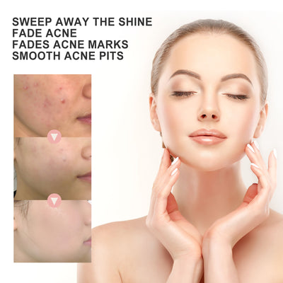 OUHOE Acne Patch Repair Acne Acne Redness Pore Cleansing & Moisturizing Patch - 5 - CJ