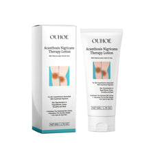 OUHOE Acanthosis Nigricans Therapy Lotion, Skin Moisturizing Clean Black Dark Heavy Alar Knee Joint Repair Carry Bright Color Of Skin - 5 - CJ