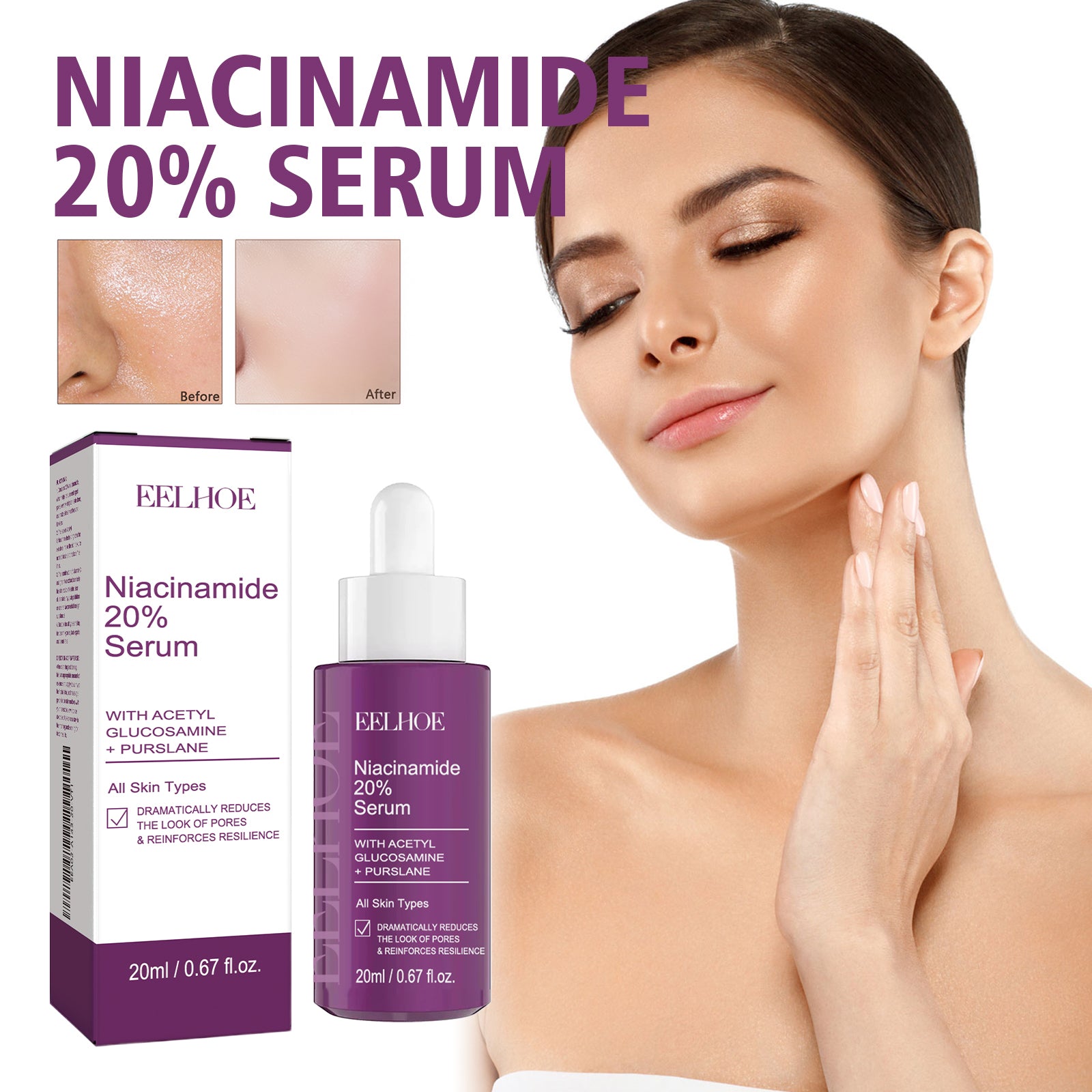 EELHOE Niacinamide Serum, Skincare Lifting Spot - Blemishing And Anti - Wrinkle Serum - 5 - CJ