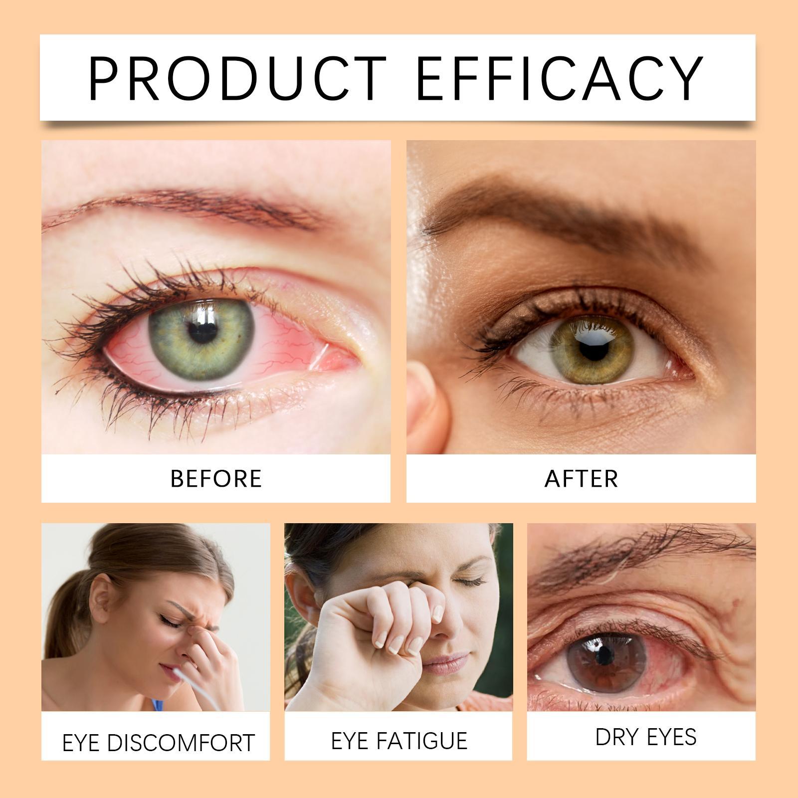 Ximengsijimeito Eye Honey Refreshing Moisturizing Soothing Dry Eyes Eye Drops - 5 - CJ