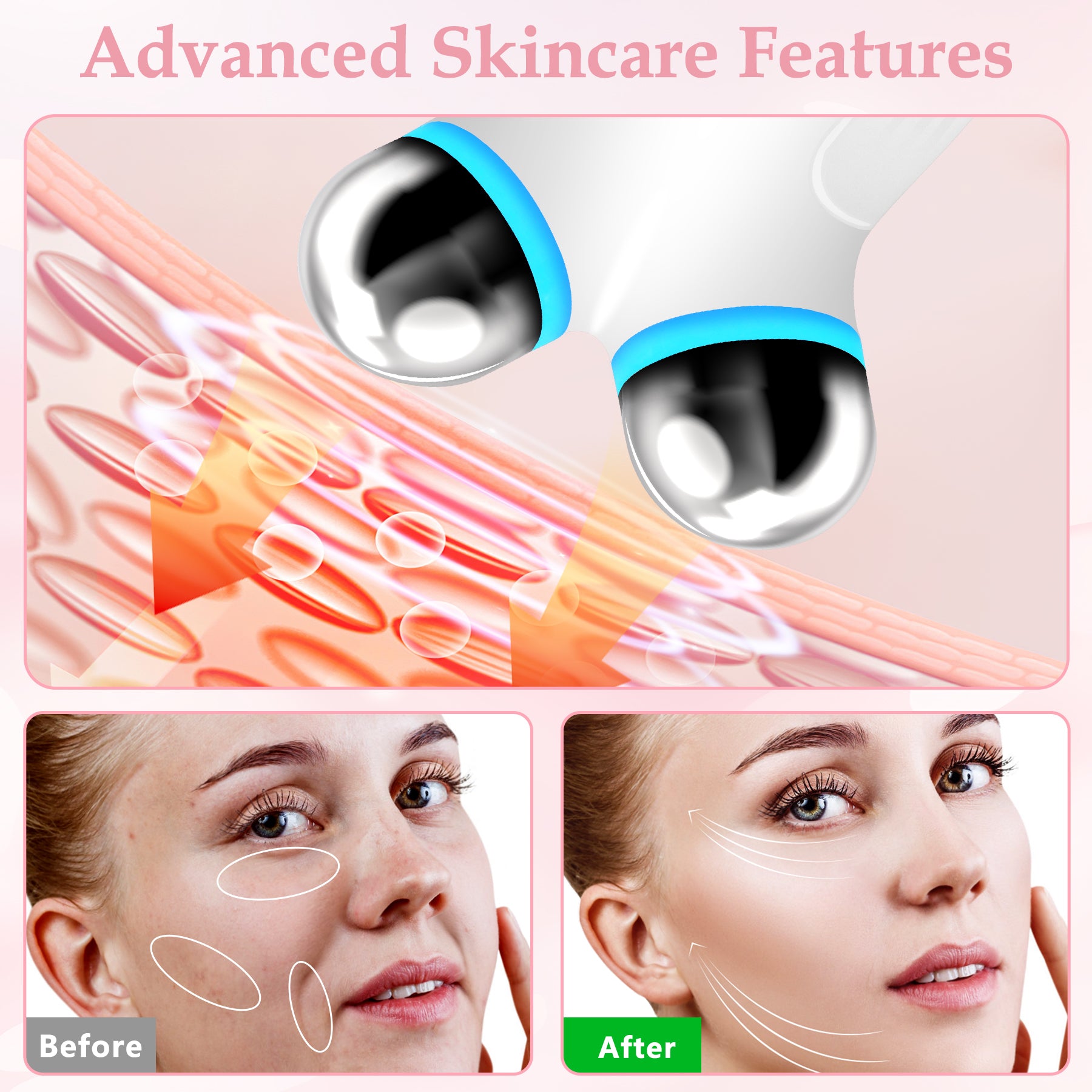 Anti Aging And Wrinkles Microcurrent Facial Device, Boost Skin Care Products Absorption - White - 5 - CJ