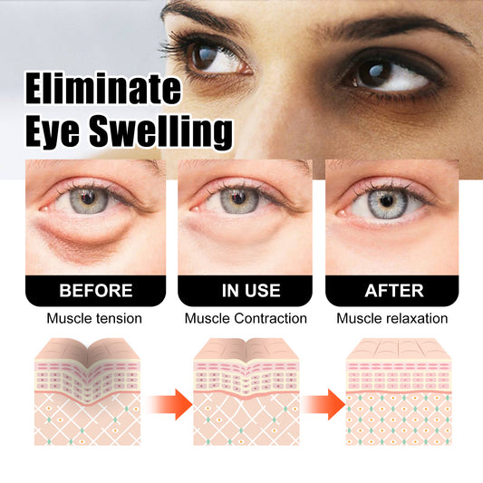 West&Month Snake Venom Peptide Eye Cream Gently Nourishes Skin, Reduces Fine Lines, Hydrates And Moisturizes Eye Cream - 5 - CJ