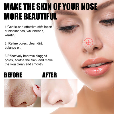 Blackhead Remover Tools - 15g Blackhead Creamwith 40Pcs Blackhead Pore Strips - 5 - CJ
