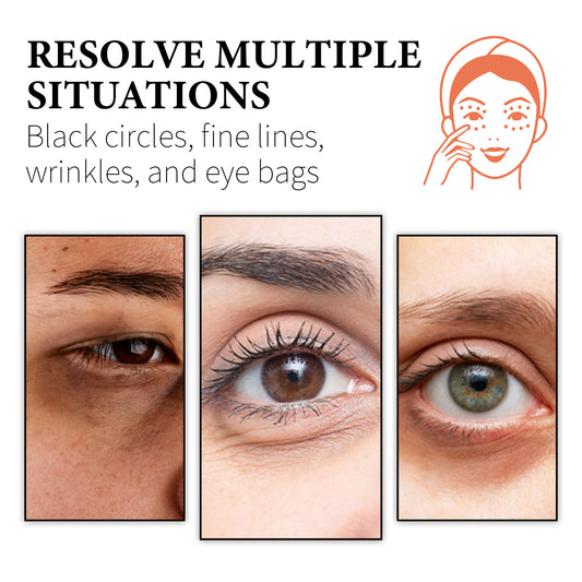 WIYUN Retinol & Collagen Moisturizer Eye Cream, Lightening Dark Circles And Bags Under Eyes Moisturizing Firming Care Multi - Effect Eye Cream - 5 - CJ