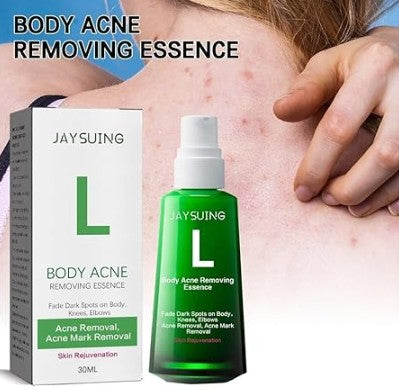 Body Pimple Repair Moisturizer