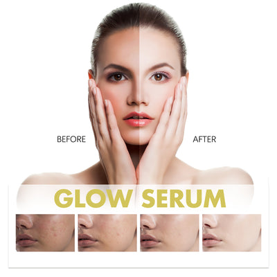 Hoygi Glow Serum, Moisturizing And Whitening Skin To Reduce Facial Spots And Fine Lines - 5 - CJ