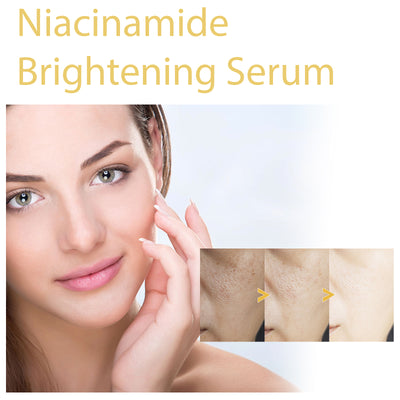 HOYGI Niacinamide Brightening Serum, Lightening Spots And Fine Lines Brightening Skin Hydrating Moisturizing Facial Treatment - 5 - CJ