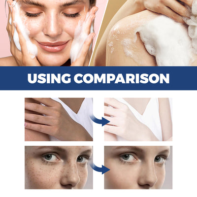 Jaysuing Spot Body Cleanser, Face Body Cleansing Skin Fade Spot Whitening Beauty Skin Cream - 5 - CJ