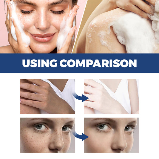 Jaysuing Spot Body Cleanser, Face Body Cleansing Skin Fade Spot Whitening Beauty Skin Cream - 5 - CJ