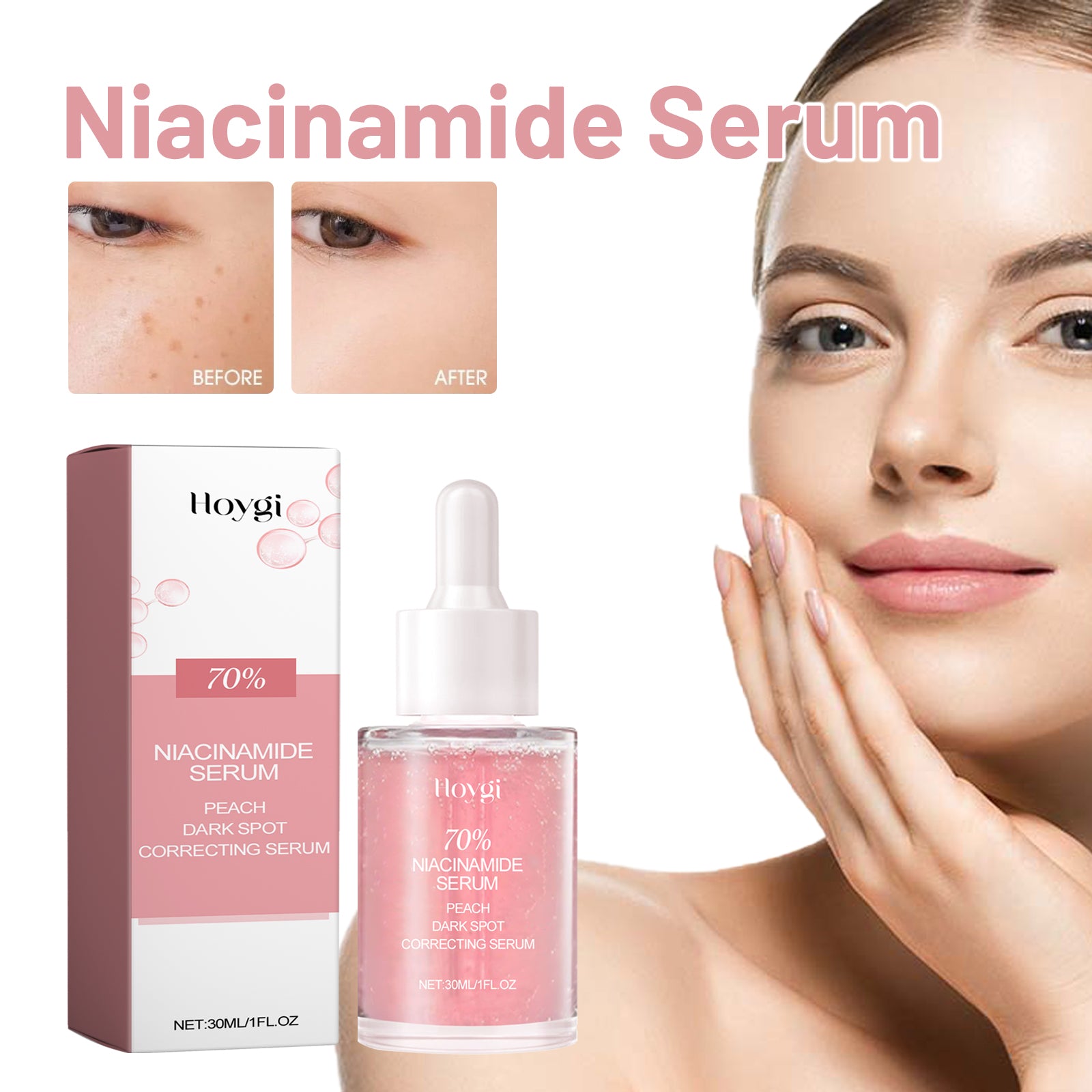 Hoygi Nicotinamide Serum Hydrates, Improves Dark, Translucent Pores, And Brighens Facial Hydrating Muscles - 5 - CJ