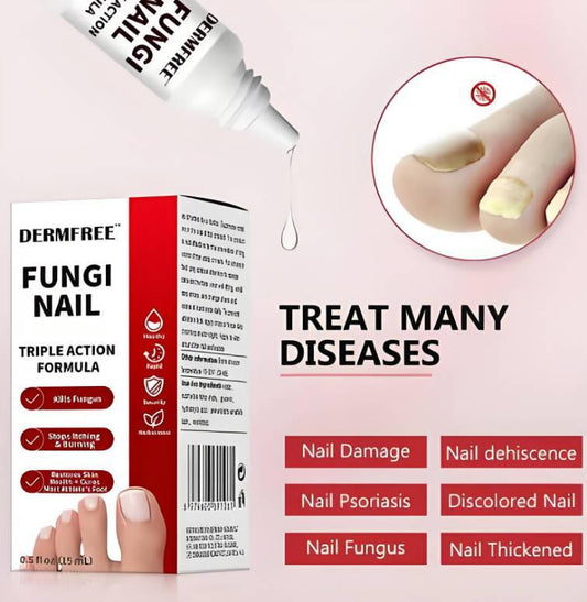 Whitenail Repair Liquid - Deep Penetrating Root Antibacterial Promotion For Healthy New Nail Growth - 5 - CJ