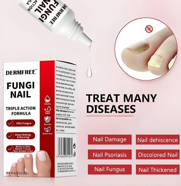 Whitenail Repair Liquid - Deep Penetrating Root Antibacterial Promotion For Healthy New Nail Growth - 5 - CJ