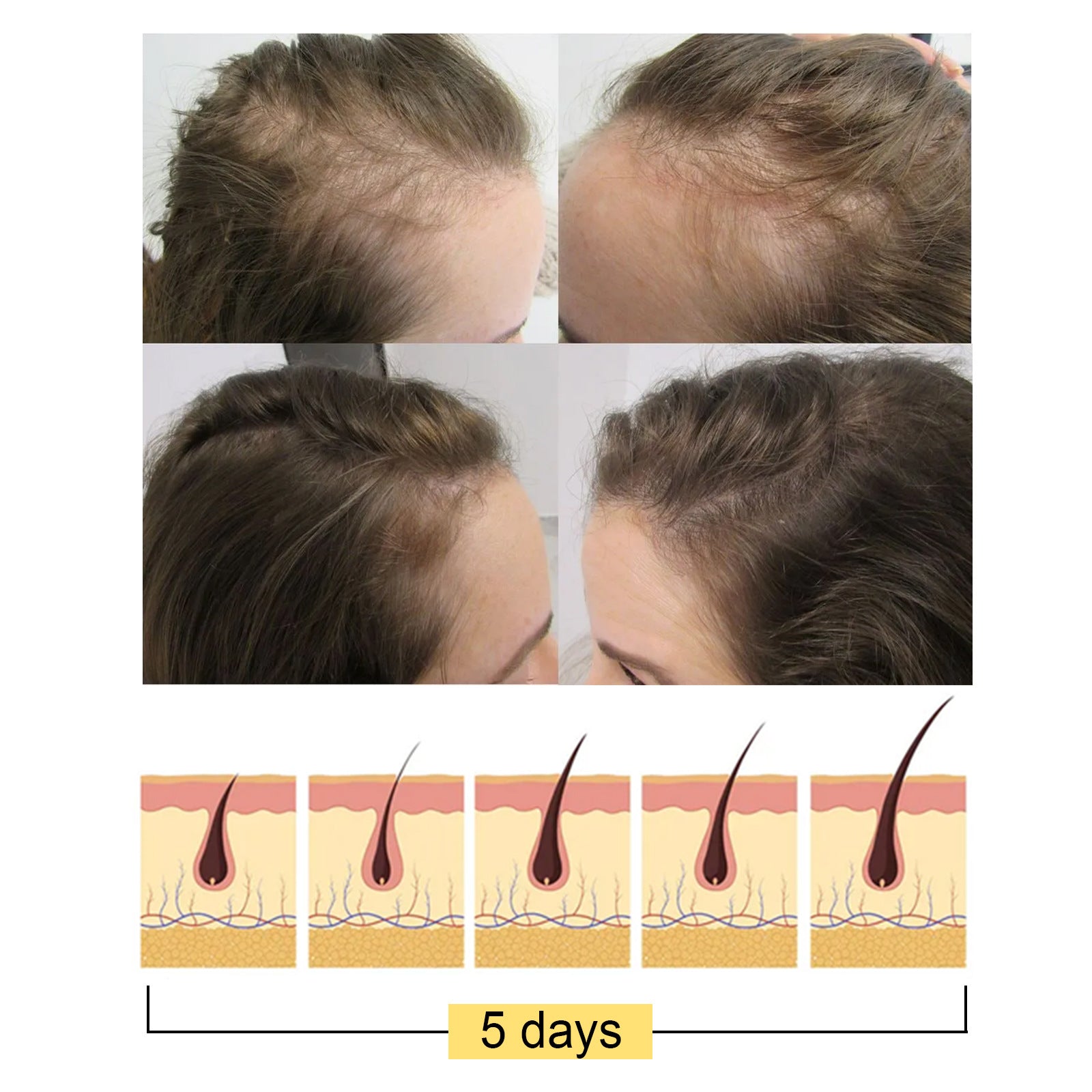 Jayswing Rice Shampoo Rice Promote Dense Hair Nourishing Repair Shampoo - 5 - CJ