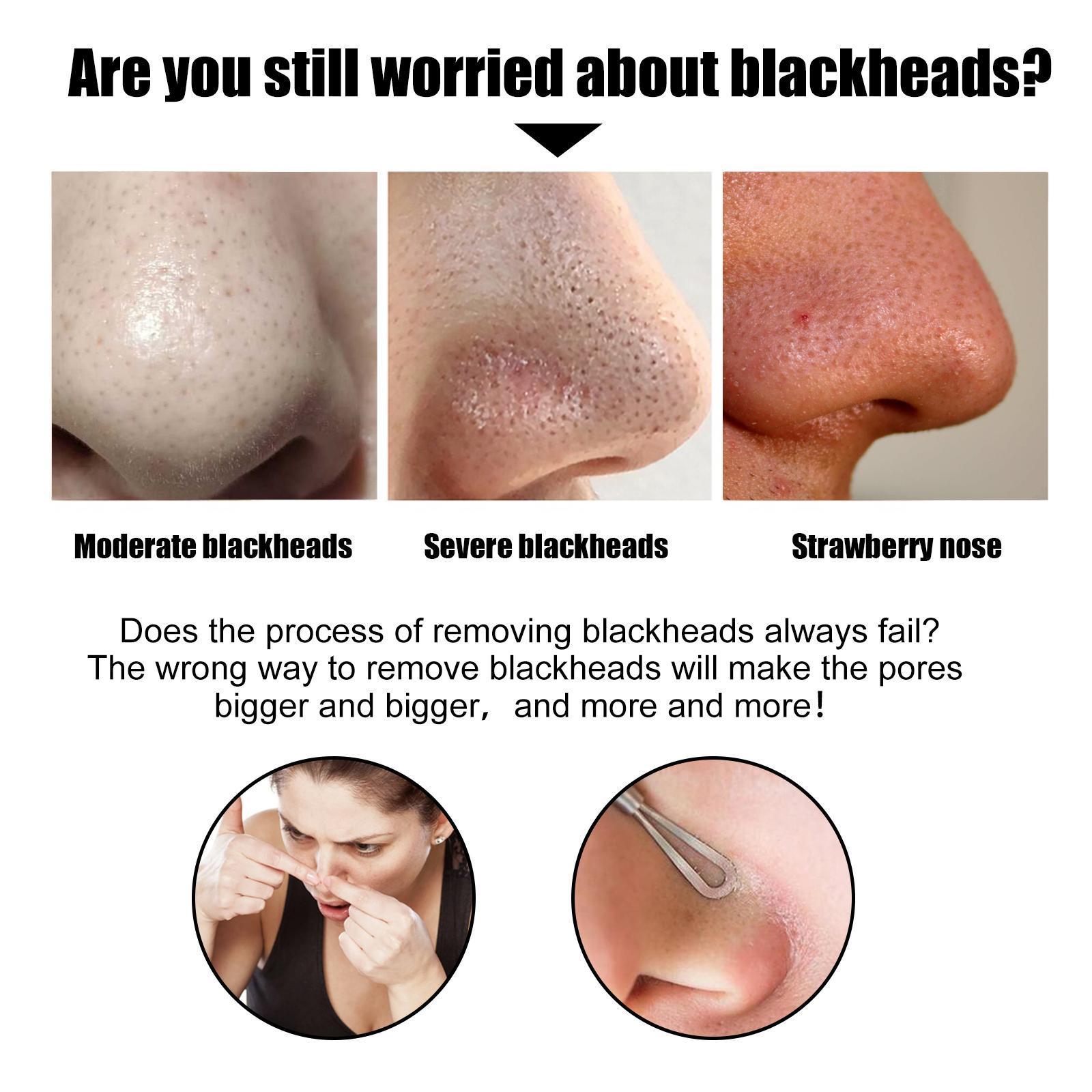 10 Pcs Blackhead Nose Patch Nose Pore Cleansing Strips Deep Cleansing Blackhead Remover Strips For Women Men - 5 - CJ