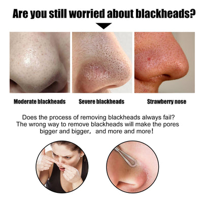 10 Pcs Blackhead Nose Patch Nose Pore Cleansing Strips Deep Cleansing Blackhead Remover Strips For Women Men - 5 - CJ