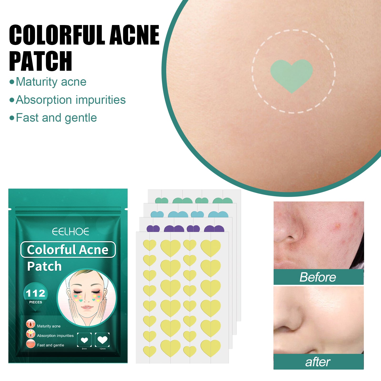 EELHOE Love Acne Patch Gentle Cleansing Acne Patch Fades Facial Acne Marks And Spots Facial Cleansing Care - 5 - CJ