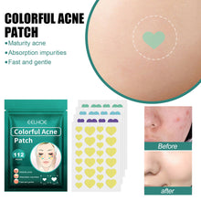 EELHOE Love Acne Patch Gentle Cleansing Acne Patch Fades Facial Acne Marks And Spots Facial Cleansing Care - 5 - CJ