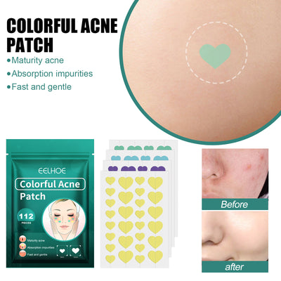 EELHOE Love Acne Patch Gentle Cleansing Acne Patch Fades Facial Acne Marks And Spots Facial Cleansing Care - 5 - CJ