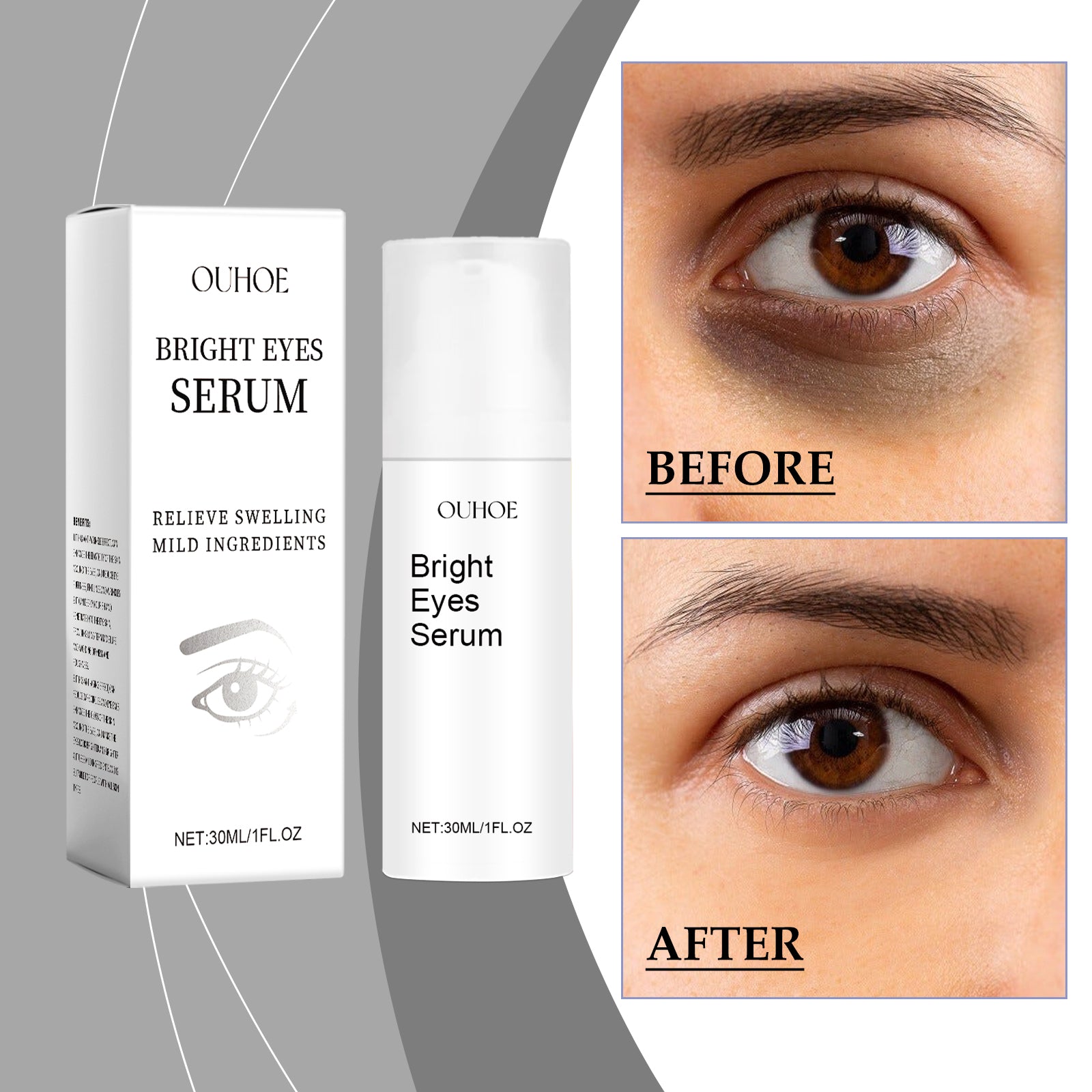 OUHOE Eye Essence Moisturizes And Tightenes The Skin Around The Eyes, Lightening The Fine Lines And Bags Under The Eyes - 5 - CJ