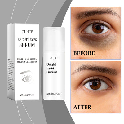 OUHOE Eye Essence Moisturizes And Tightenes The Skin Around The Eyes, Lightening The Fine Lines And Bags Under The Eyes - 5 - CJ