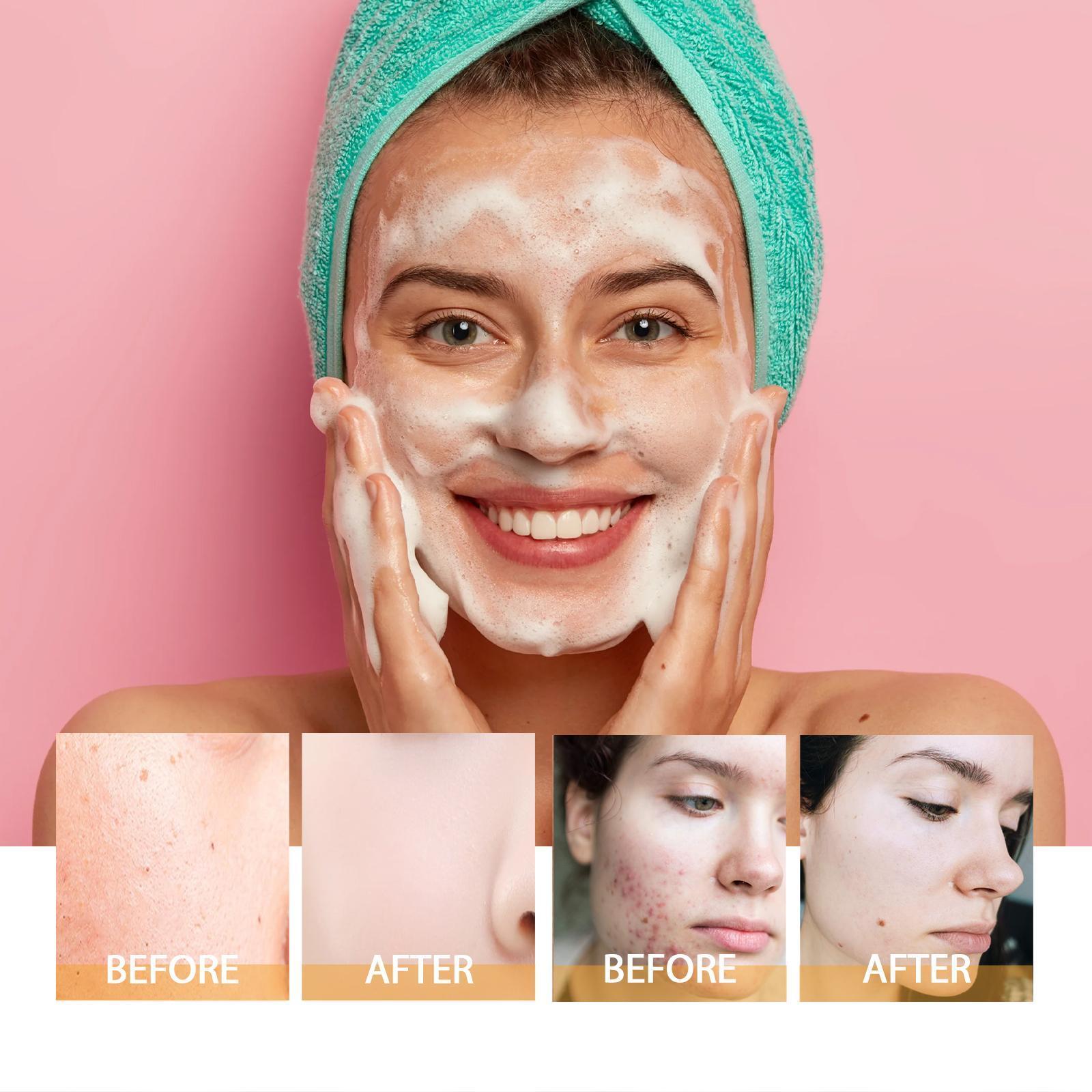 Hoijji Brightening Facial Cleanser, Deep Cleansing Facial Skin, Fades Acne Marks, Moisturizes And Whitens - 5 - CJ