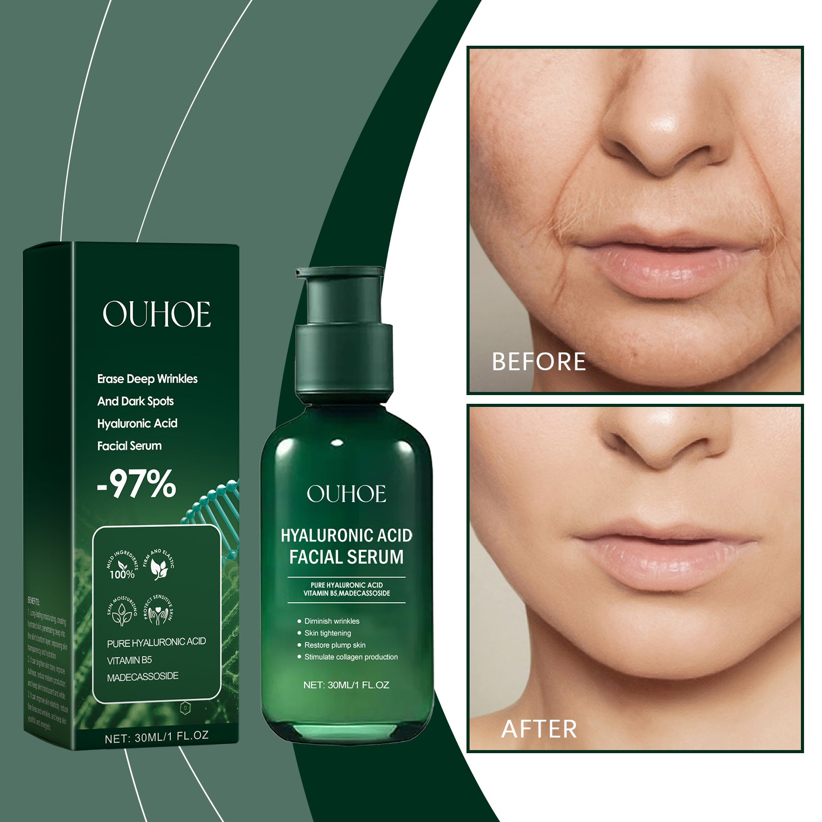 OUHOE  Facial Essence, Moisturizing And Moisturizing Skin Brightening Care Gentle Care Of Facial Skin - 5 - CJ