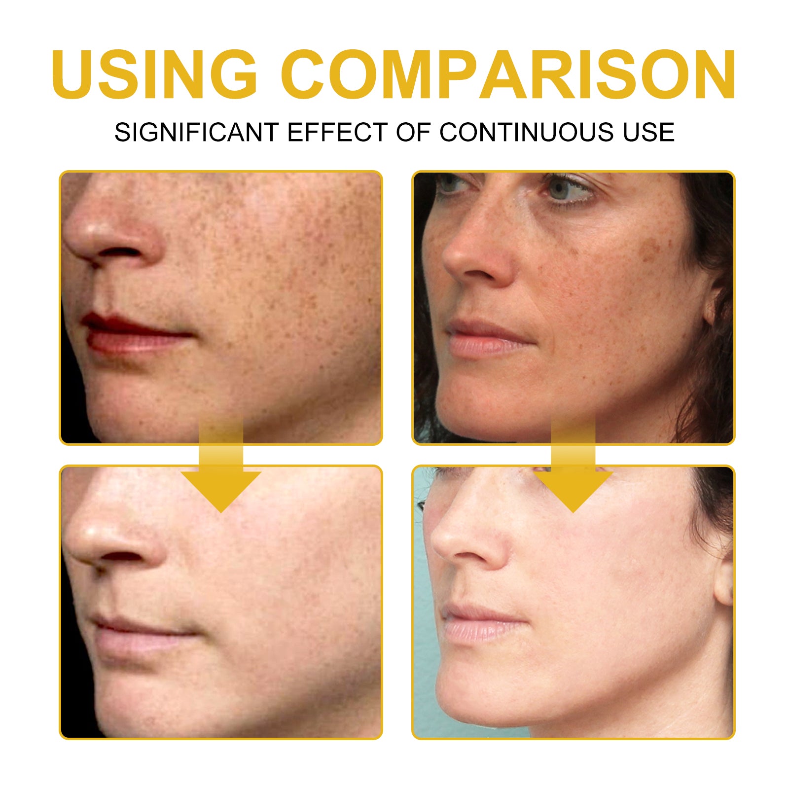 Wiyun V7 Whitening Cream Reduces Wrinkles And Fine Lines On The Face, Moisturizes And Brightens Skin, Anti - Aging And Replenishing Cream - 5 - CJ